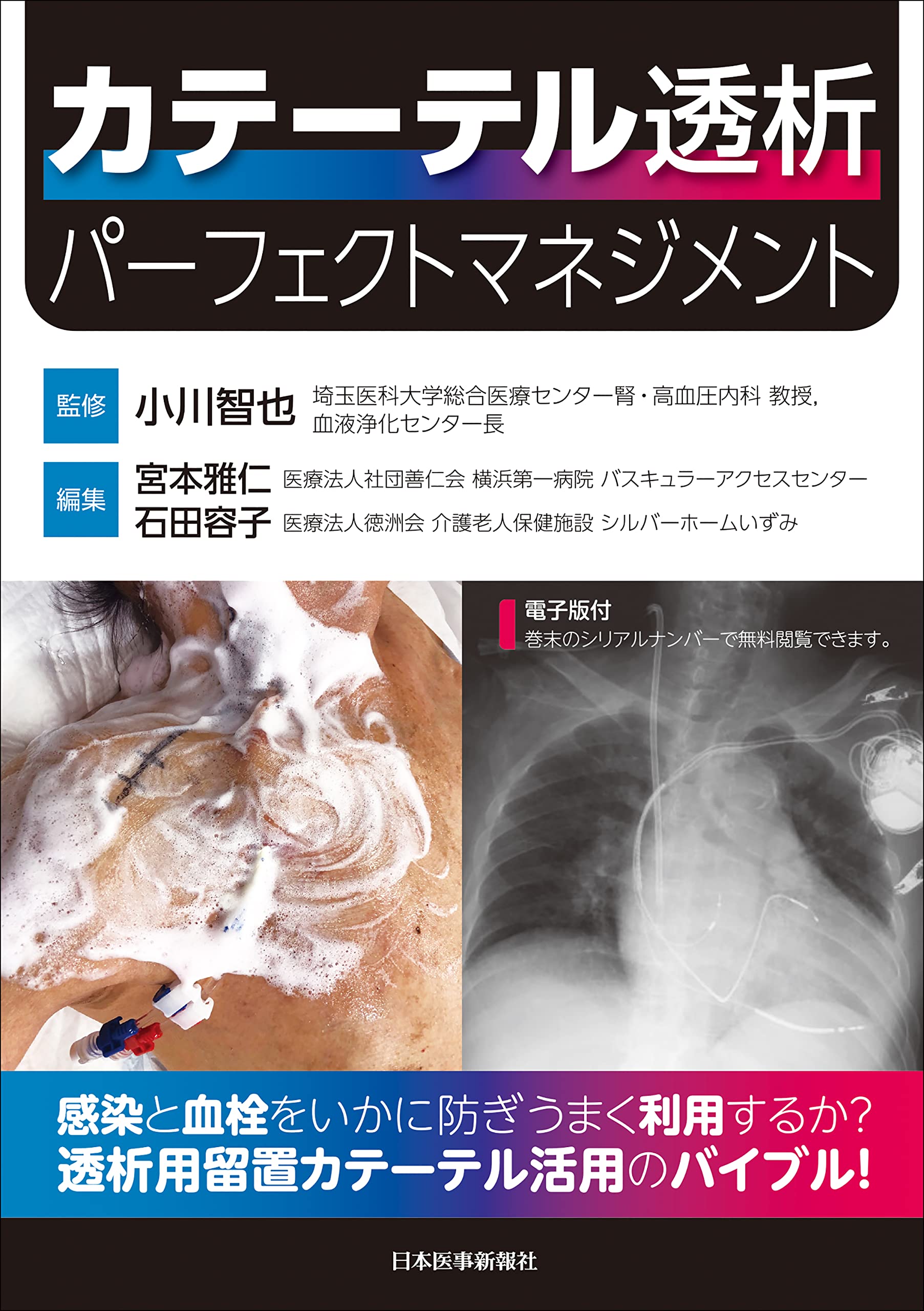 バラ売り可＞人工透析等 カテーテル保護資材等