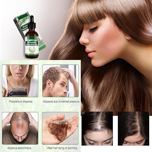 Miniatura 6 de Aceite de Romero para, Aceite de Romero para el Crecimiento Del Cabello, 1 Masajeador, Aceite de Ricino para Cejas y Pestañas y Cuidado de la Piel