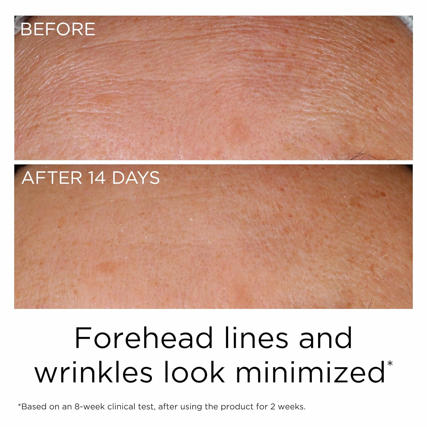 Elizabeth Arden PREVAGE Anti-Aging Face Serum 2.0 for Women, Brightening & Dark Spot Correcting Skincare, With Antioxidant Idebenone Technology - Image 8