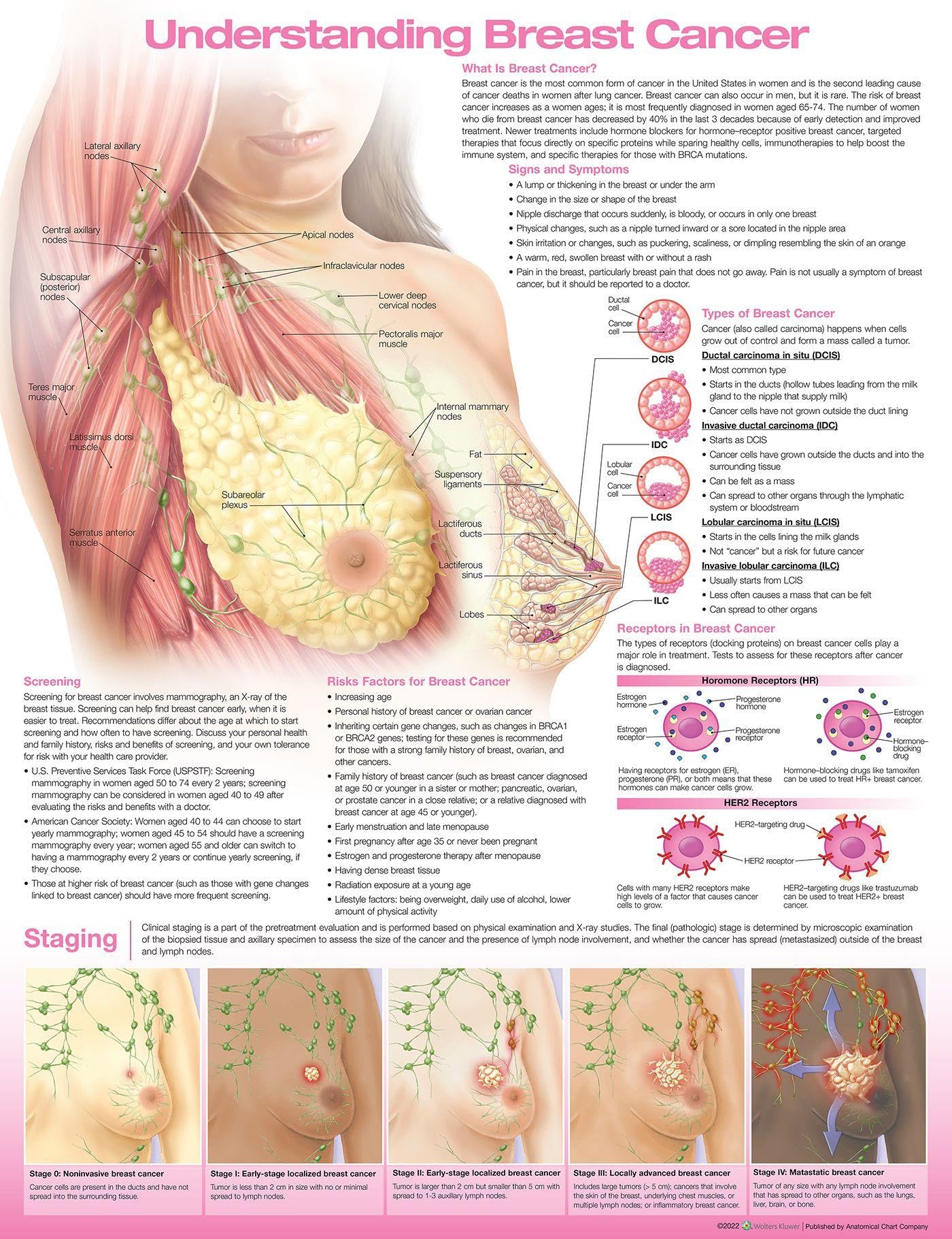 Preast Cancer Understanding Breast Cancer Anatomical Chart | Adobooks