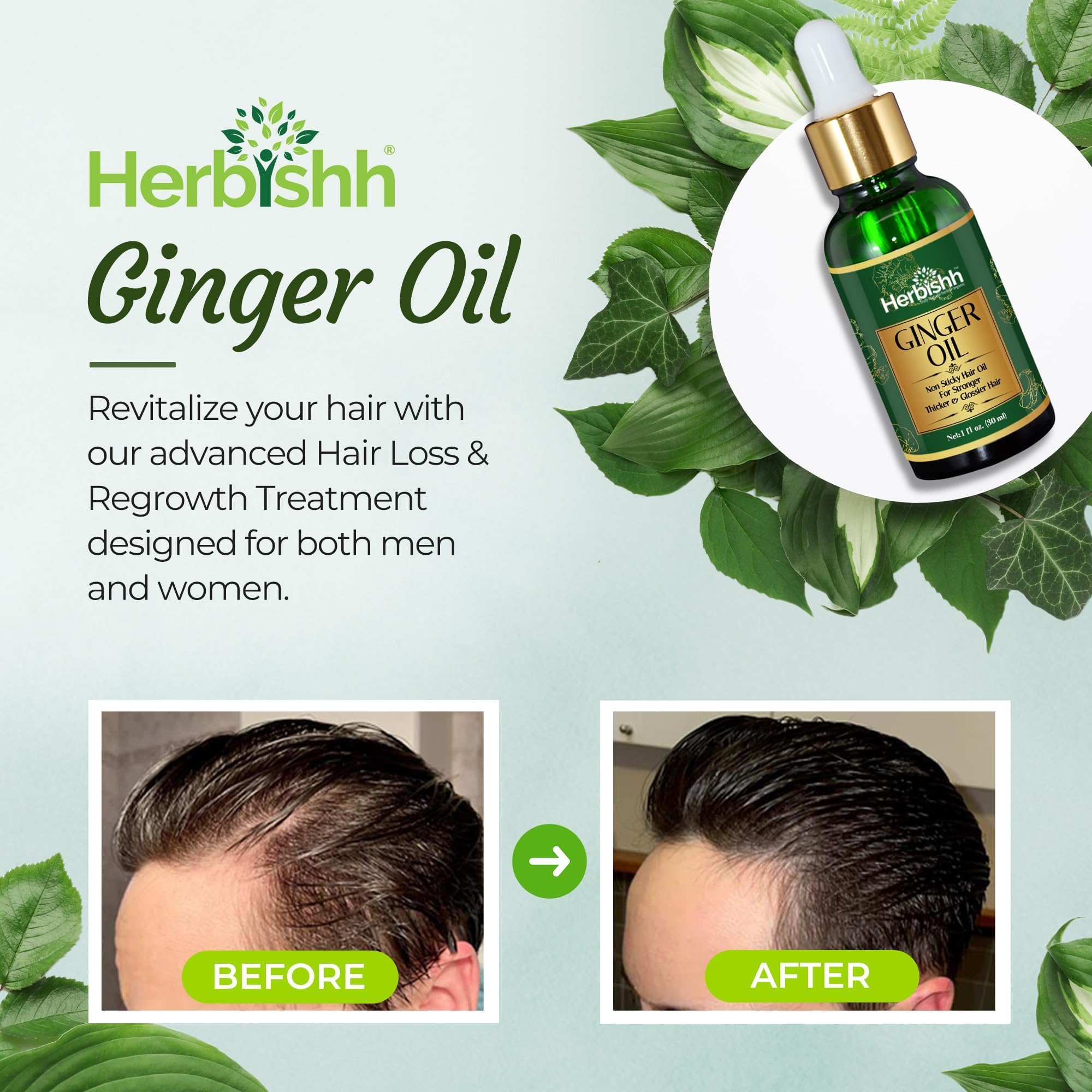 Herbishh Ginger Hair Oil For Hair Growth, With Ginger Extract- Fast Hair Growth Dense Regrowth Ginger Serum Oil - Image 4