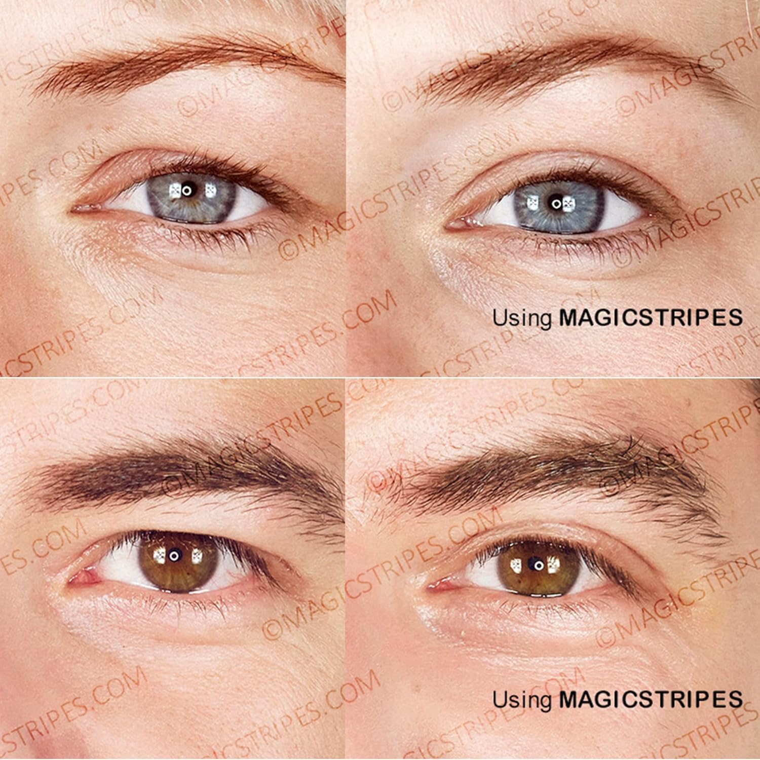 MAGICSTRIPES Eyelid Lifting Stripes Trial Pack S+M+L (TRIAL)