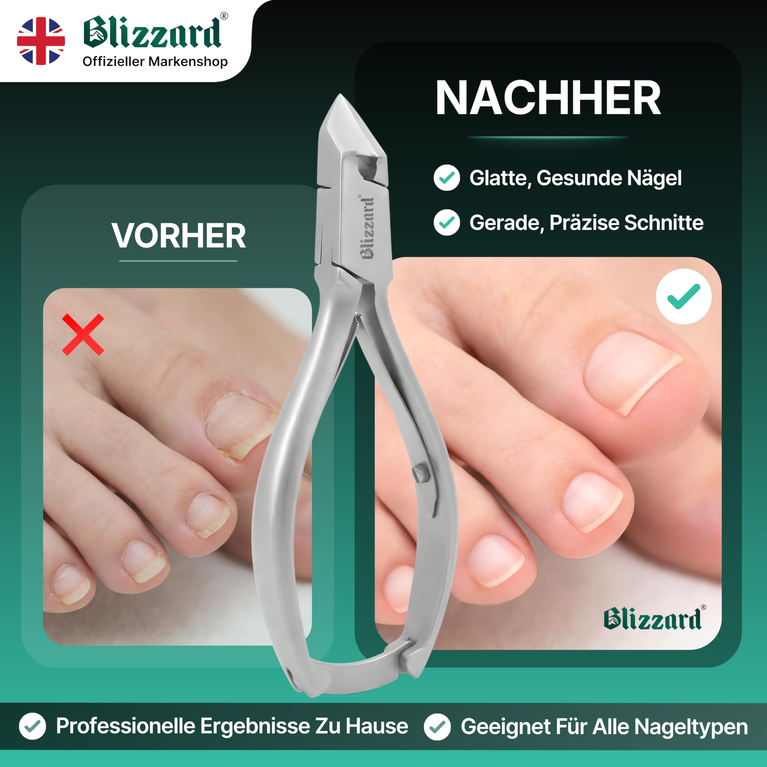 Blizzard Nagelzange für Fußnägel – Nagelzange mit Kopfschneider für dicke & eingewachsene Zehennägel – Profi Pediküre Fußpflege Werkzeug aus Edelstahl inkl. Metall Nagelfeile – 13,5 cm