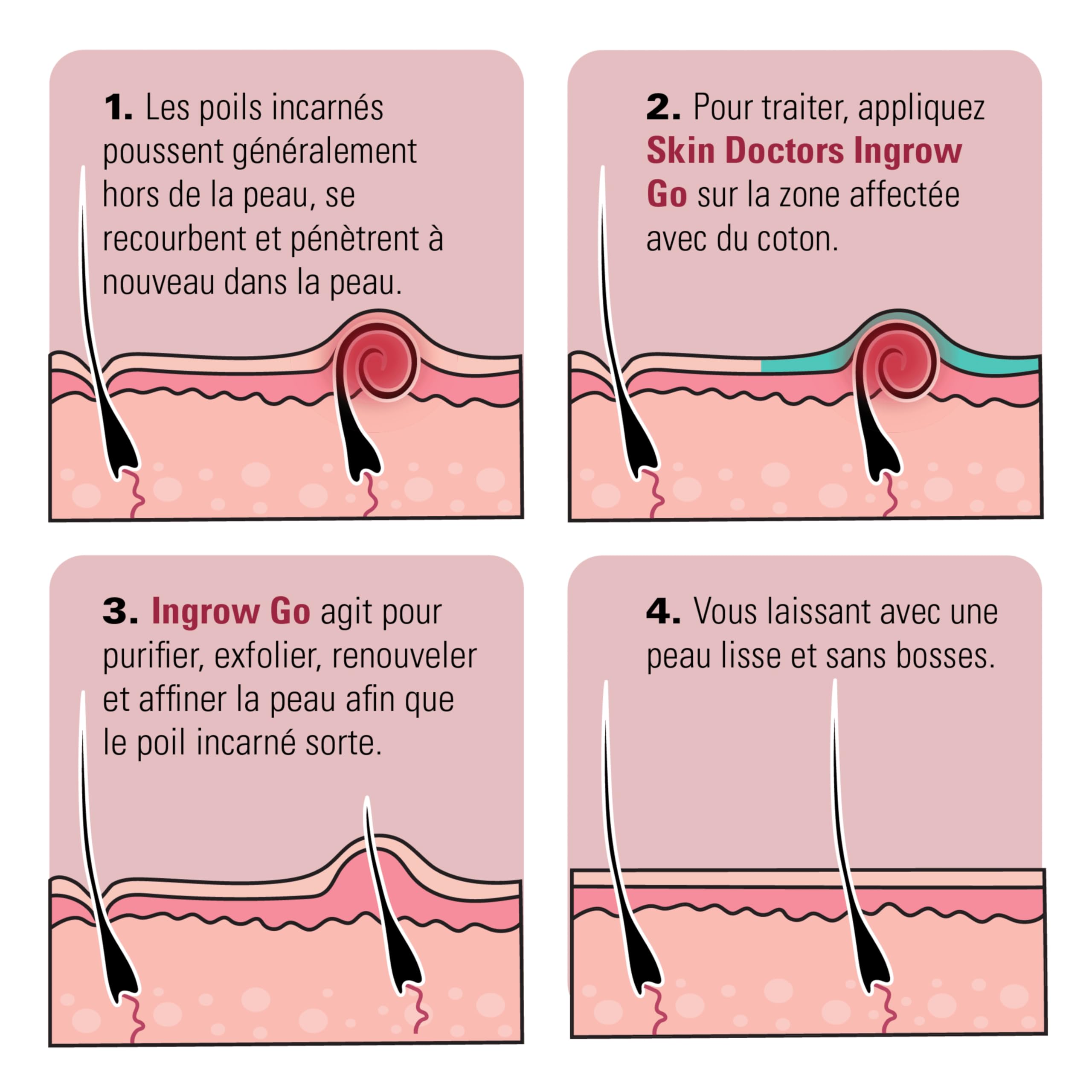 Skin Doctors Ingrow Go Lotion, Soin Anti-Poils Incarnés, Prévient et Réduit les Poils Incarnés après Rasage ou Épilation, Jambes, Zone du Maillot, Aisselles, Visage, 120 ml