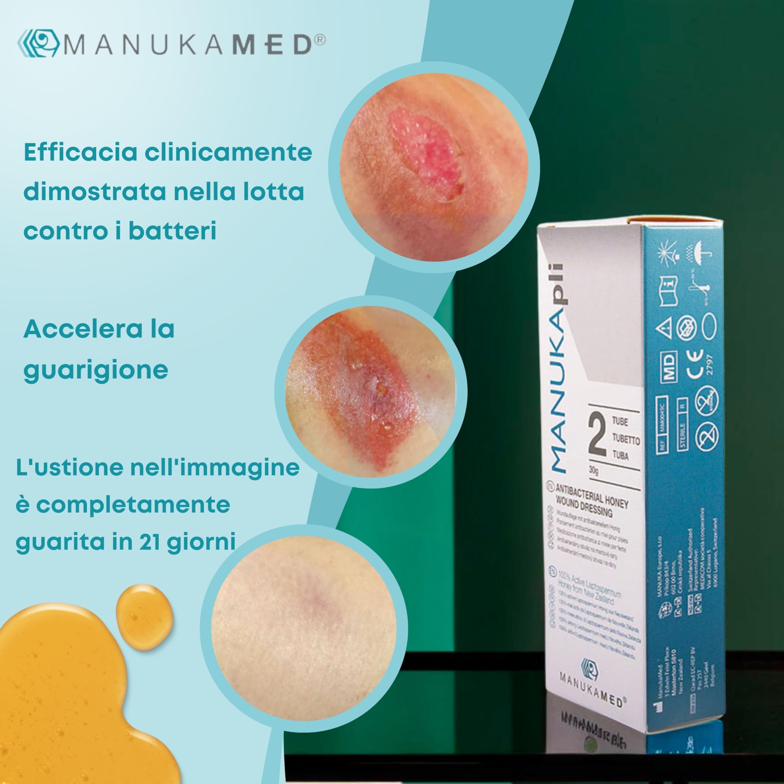 ManukaMed MANUKA, qualità medica, cura delle ferite e della pelle, miele di Manuka bioattivo al 100%, unguento per le ferite e la guarigione, STERILE MGO 560+/2x15 g