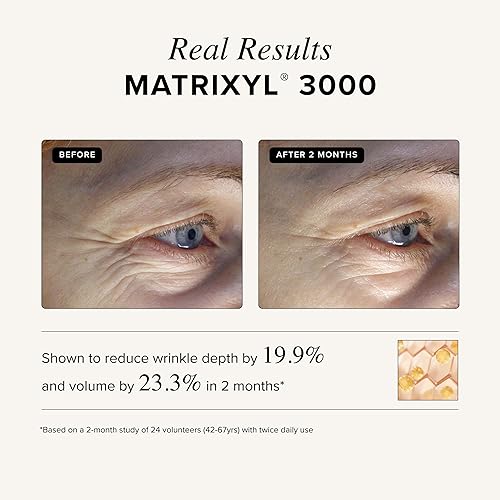 Miniatura 4 de Asterwood Matrixyl 3000 + Argireline Serum for Face - Multi Peptide Serum with Hyaluronic Acid - Anti-Aging, Wrinkle Reducing, Collagen Boosting