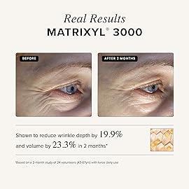 Asterwood Matrixyl 3000 + Argireline Serum for Face - Multi Peptide Serum with Hyaluronic Acid - Anti-Aging, Wrinkle Reducing, Collagen Boosting - Fragrance-Free - 8 Fl Oz