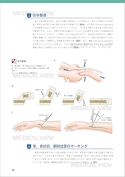 小児の骨折と手術［Web動画付］ (新OS NEXUS) | 大谷 卓也 |本