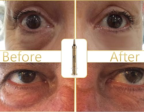 Miniatura 6 de Crema instantánea GLO24K con oro de 24 quilates ácido hialurónico péptidos y vitaminas A C E Una potente alternativa no invasiva a las inyecciones