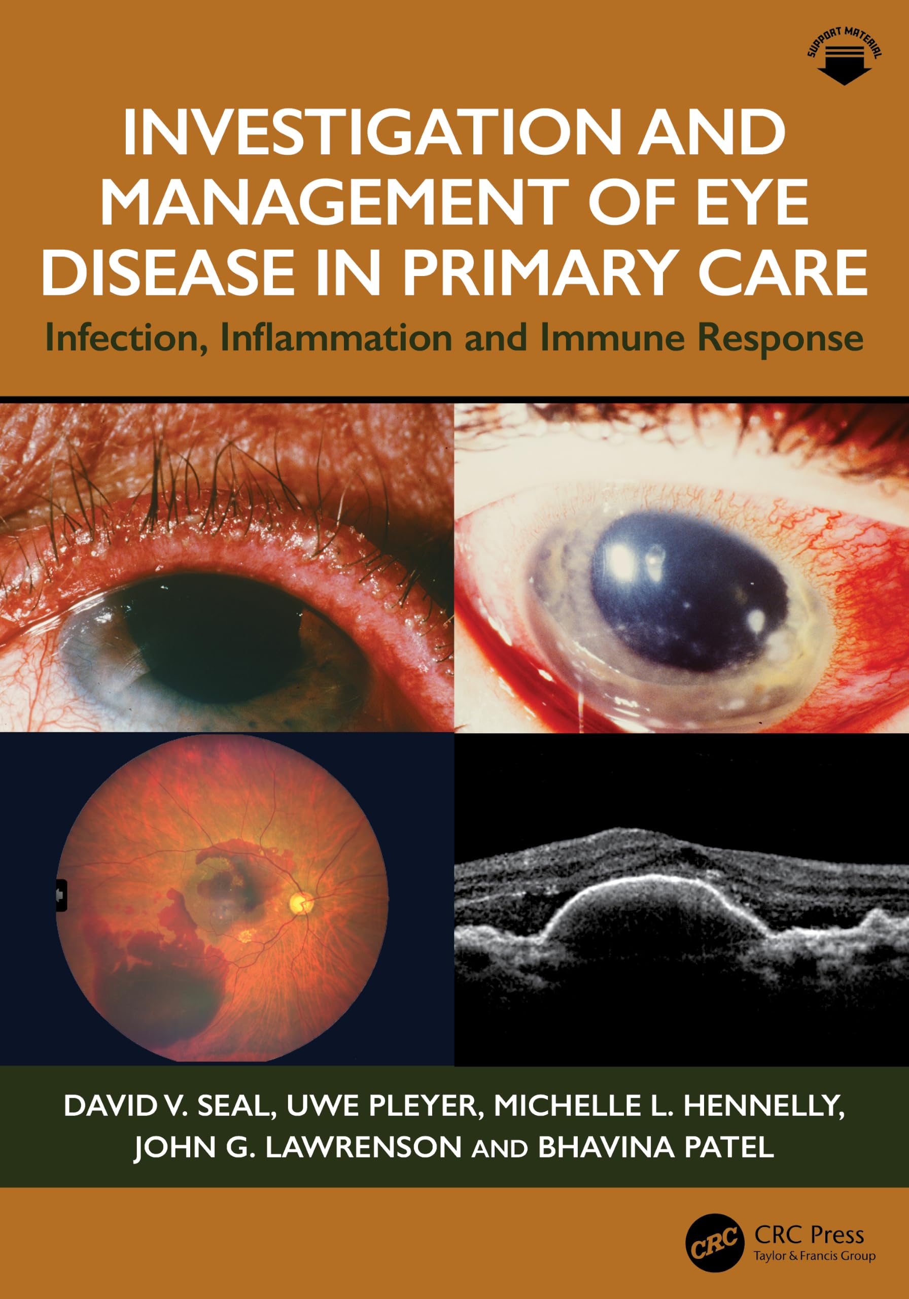 Investigation  Management of Eye Disease in Primary Care by David V. Seal