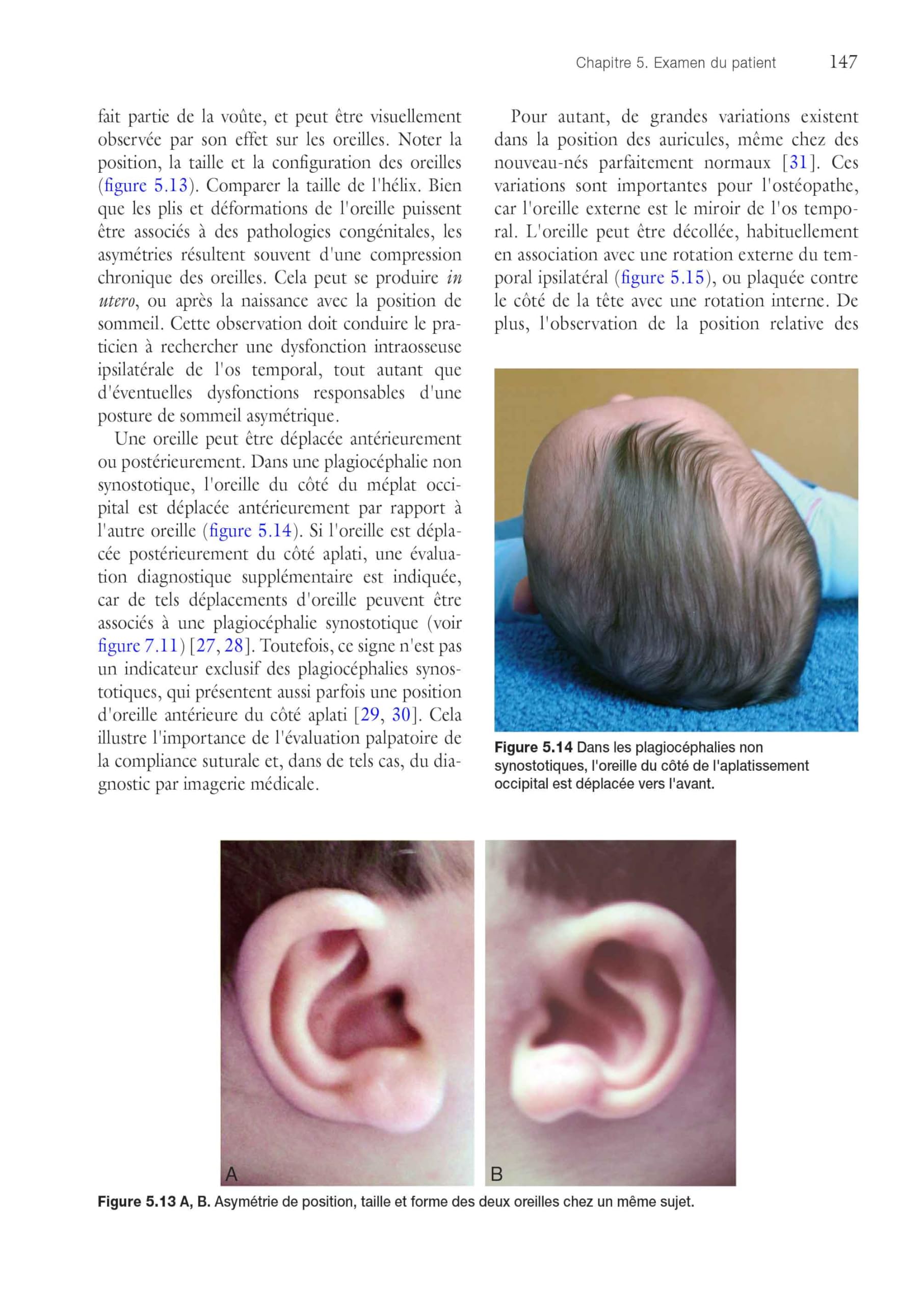 Ostéopathie pédiatrique
