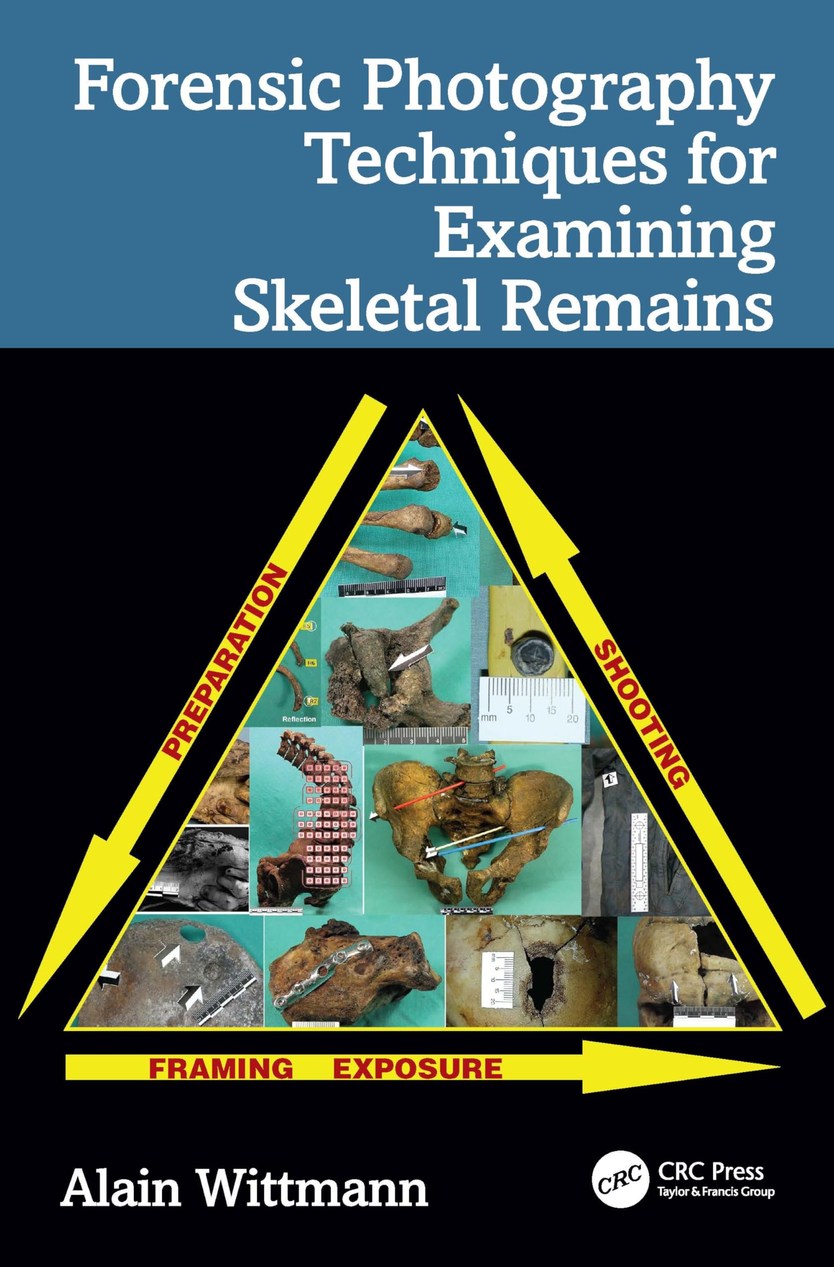 Forensic Photography Techniques for Examining Skeletal Remains