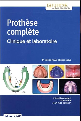 Prothèse complète: Clinique et laboratoire