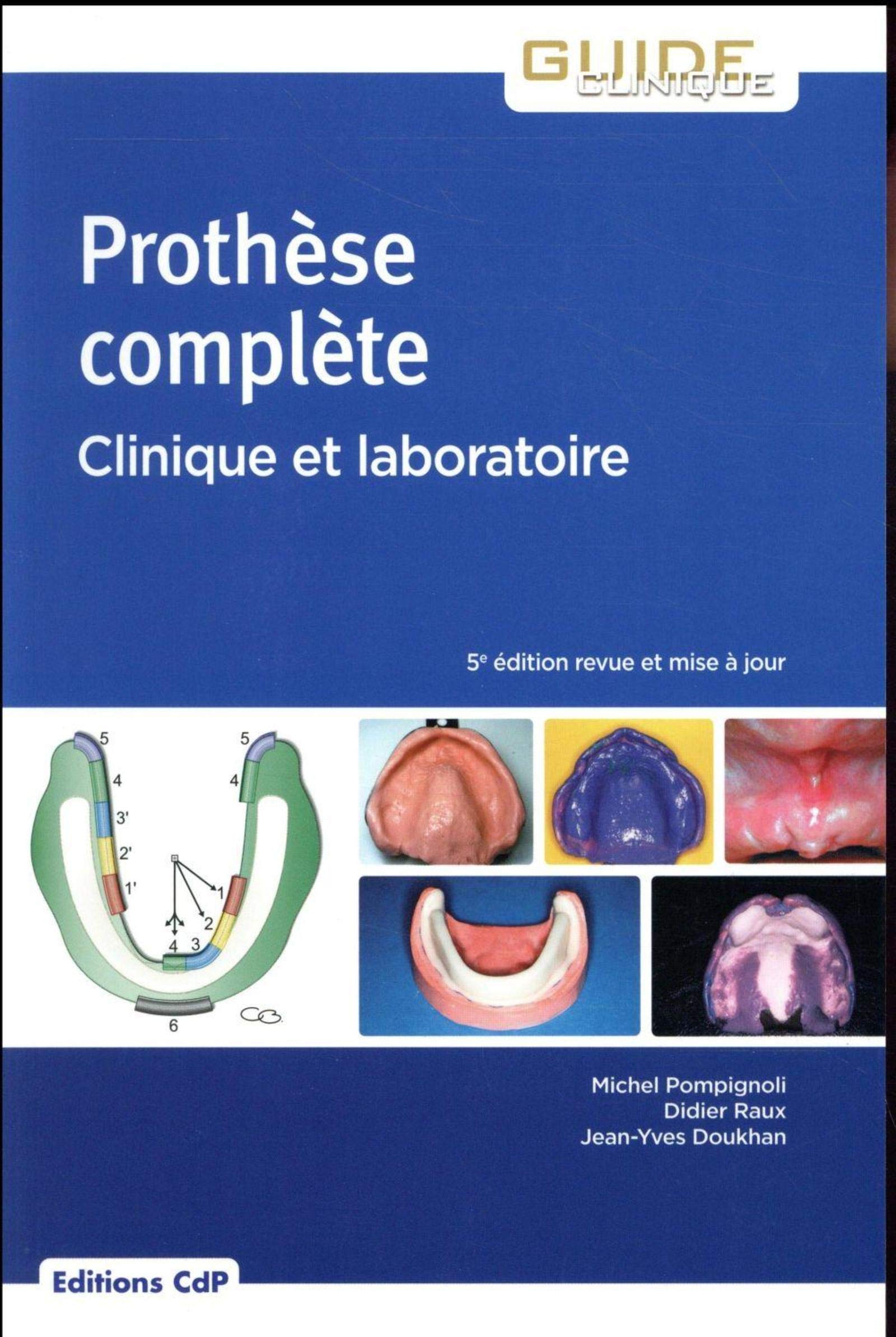 Prothèse complète: Clinique et laboratoire