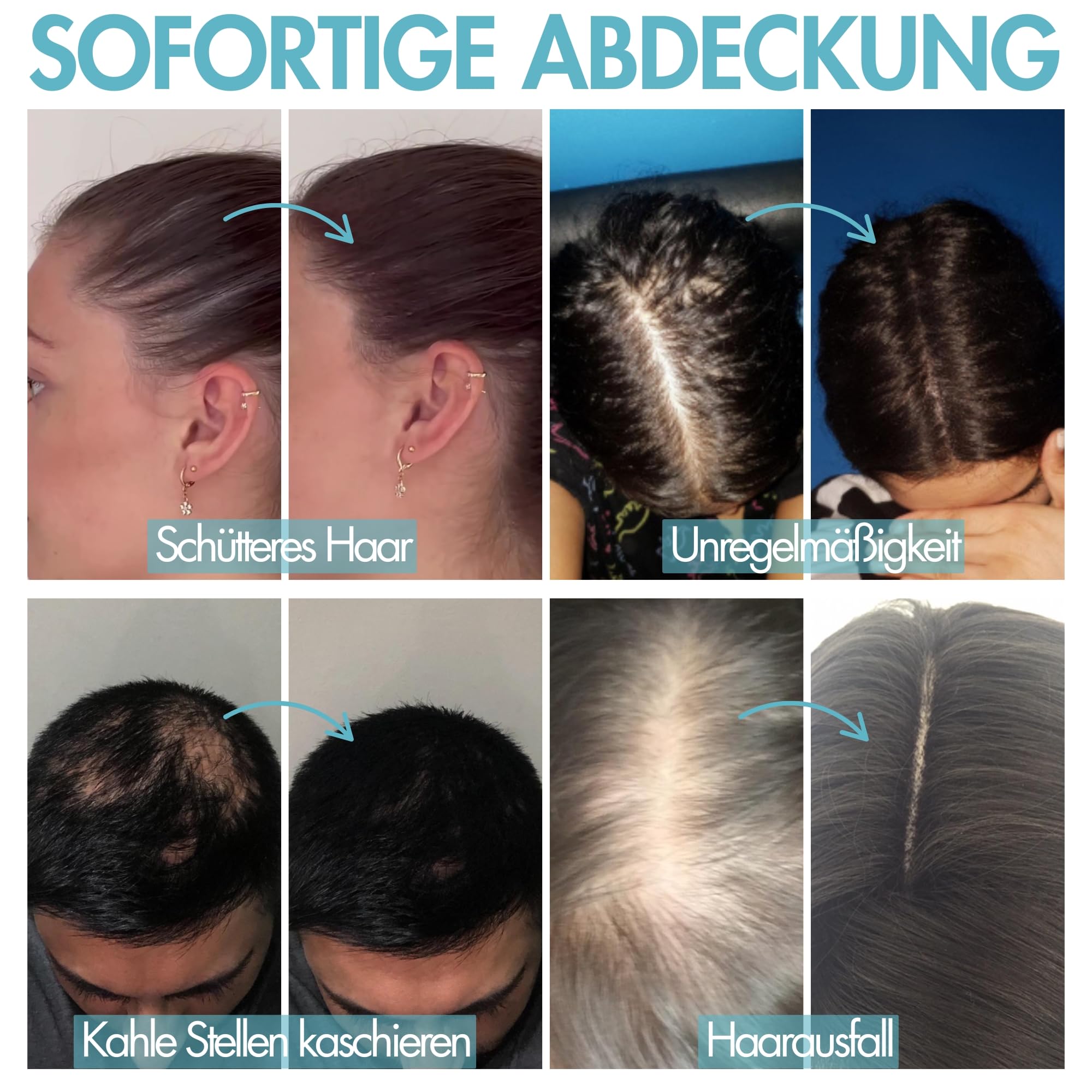 Hair Genetics Streuhaar Nachfüllpackung Für Natürliche Haarverdichtung - Haarpuder Männer Und Frauen Bei Haarausfall, Geeignet Für Dünnes Haar, Graue Ansätze, Wasserfest (Dunkelbraun, 50g)