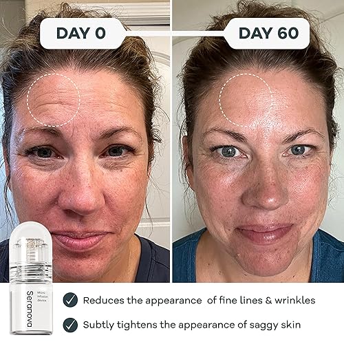 Miniatura 6 de Seranova - Micro infusión para el cuidado de la piel (suministro de 2 meses)