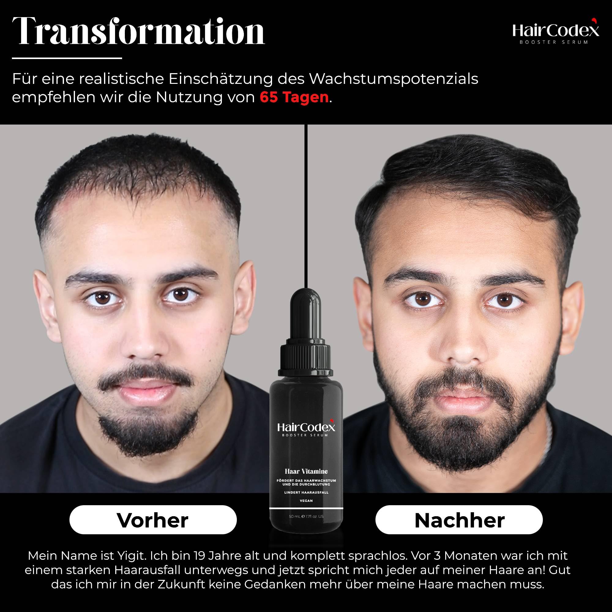 Booster Serum 3x 50ML Haarwuchsmittel mit Biotin und Keratin, 1x HC Stimulator Dermaroller für Haare oder Bart, Erblich Bedingten Haarausfall, 150 ml