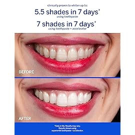 Supersmile Flouride Free Citrus Blast 8 oz