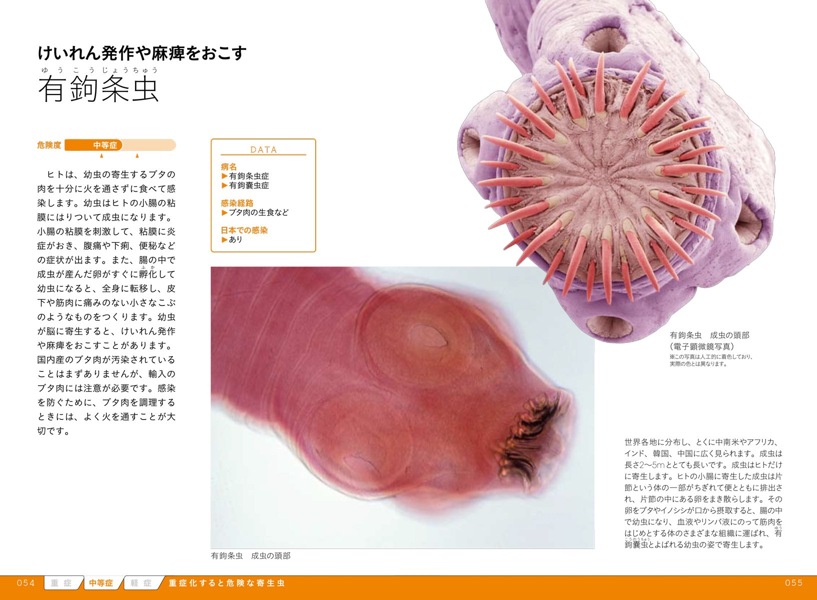 Amazon Co Jp 寄生虫ビジュアル図鑑 危険度 症状で知る人に寄生する生物 篤郎 濱田 Japanese Books