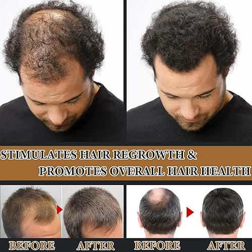 Miniatura 3 de Champú para hombres y mujeres