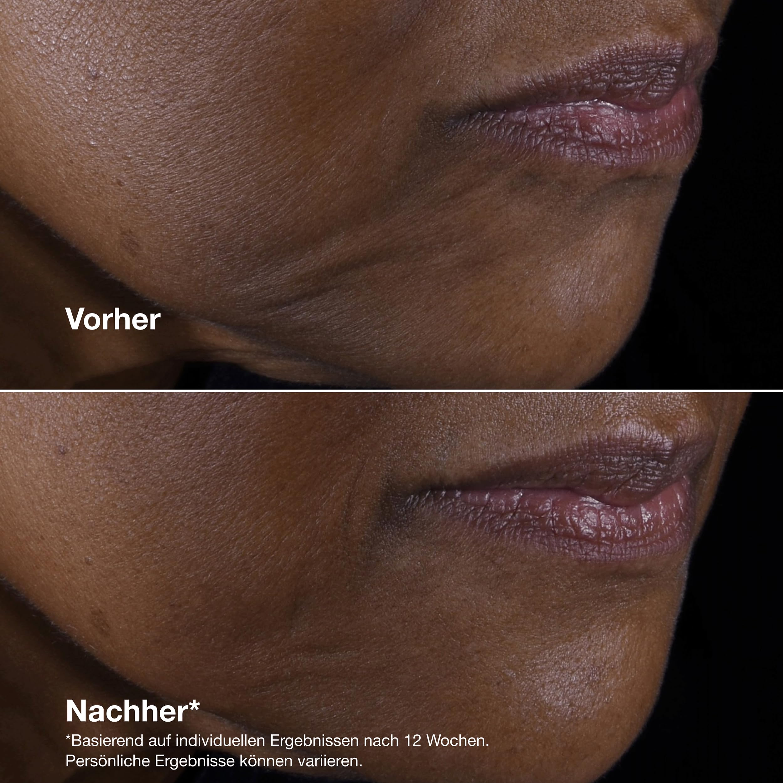 Clinique Smart Clinical Repair™ Lifting Face + Neck Cream | Mit 9% Peptiden + Hyaluronsäure | Anti-aging + feuchtigkeitsspendend
