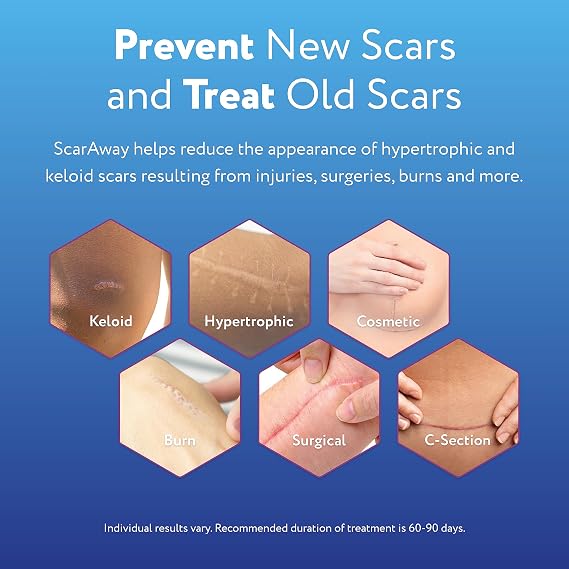 ScarAway Scar Diminishing Gel, 10 Gram