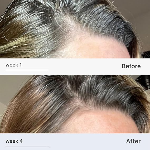 Better Not Younger Hair Thickening Serum for Women Over 40 Scalp Care, Hair Density Treatment and Anti-Aging 2fl.oz Fortifying Serum with Biotin & Ginger. Promotes Stronger, Thicker-Looking Hair.