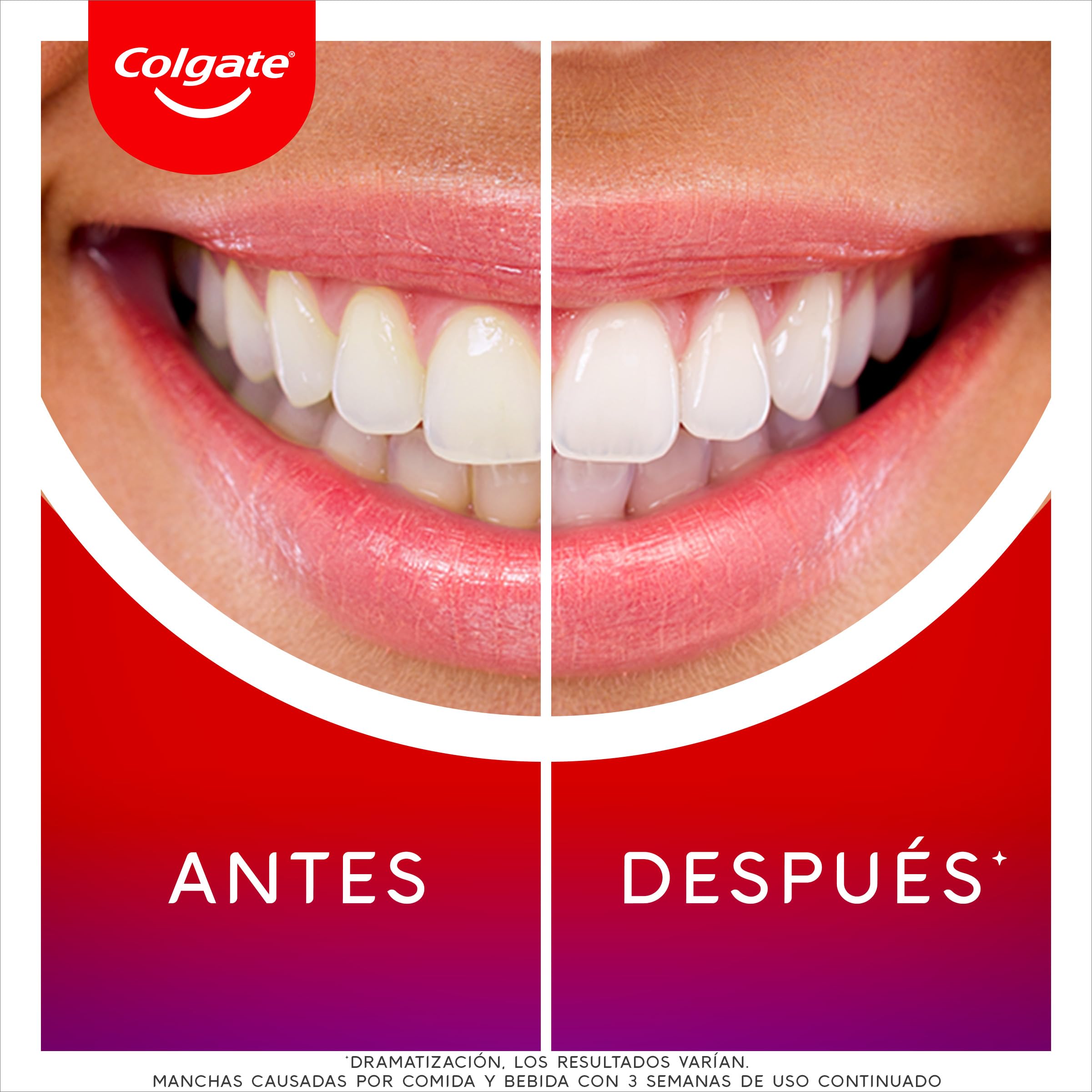 COLGATE Max White Ultimate Kit de Blanqueamiento Dental LED en Casa, Seguro para el Esmalte, Revierte hasta 20 Años de Manchas, Incluye Pincel Blanqueador