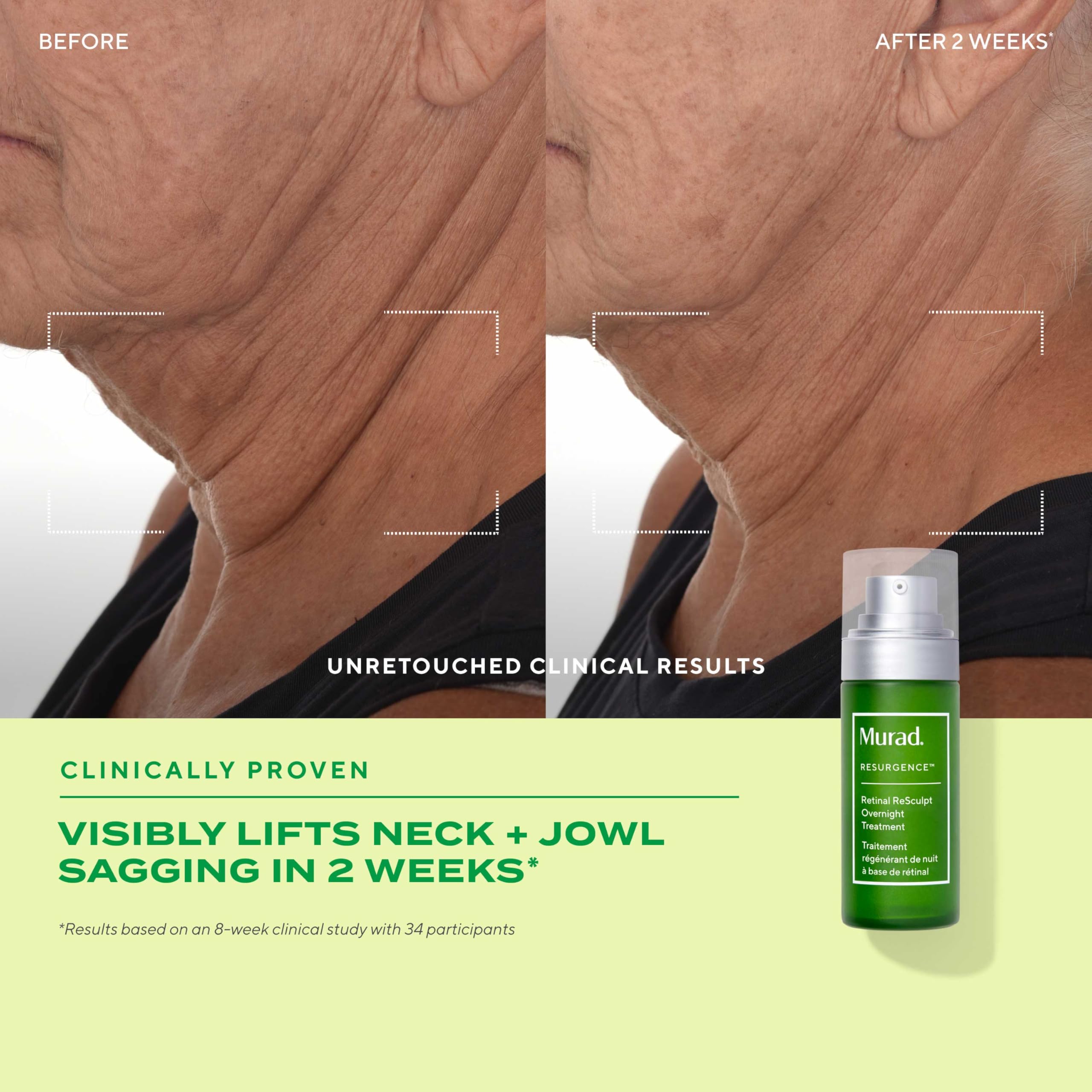 Murad Retinal ReSculpt Overnight Treatment, Anti-Ageing Retinal Night Serum for Deep Wrinkles & Fine Lines - Image 4