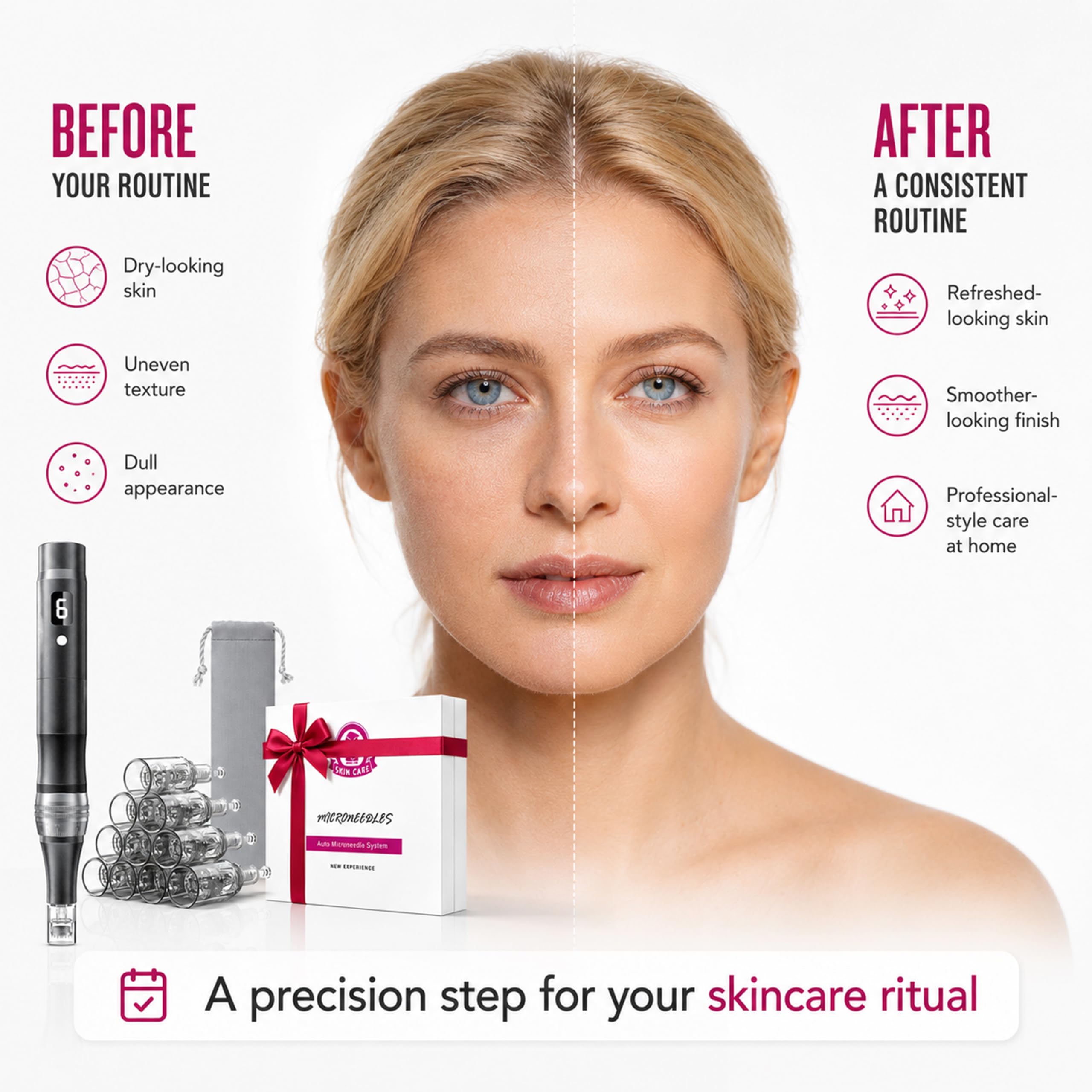 Rechargeable Microneedling Pen – Microneedle Derma Roller Pen for Women and Men Home Use-0.25MM Black