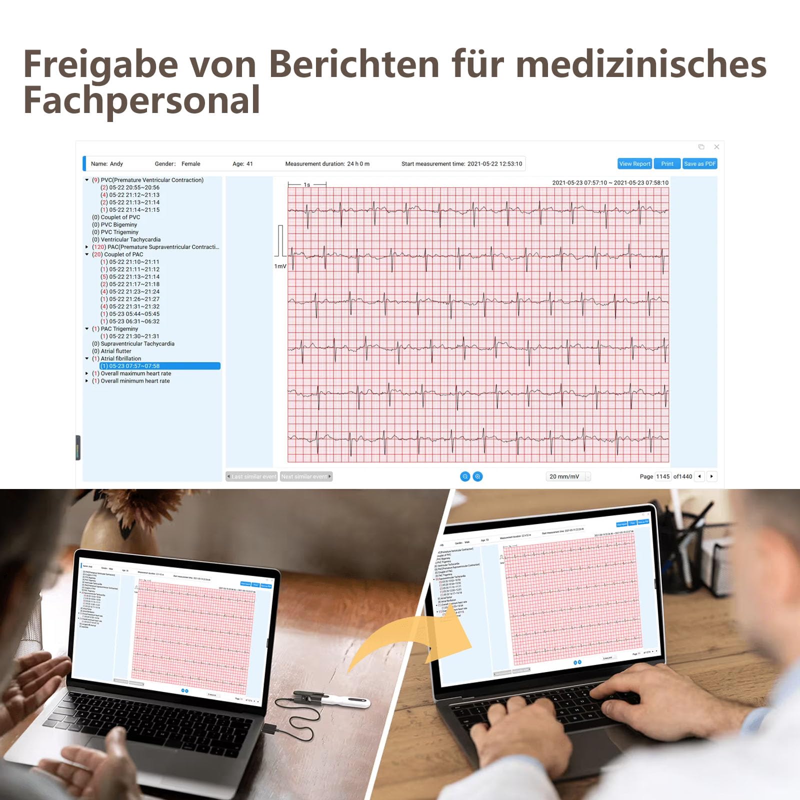 Wellue 24 ore dispositivo ECG per la casa, analisi AI, ECG Event Recorder, compatibile con Ios e Android, Mac e Windows, tempo di monitoraggio da 5 minuti a 24 ore