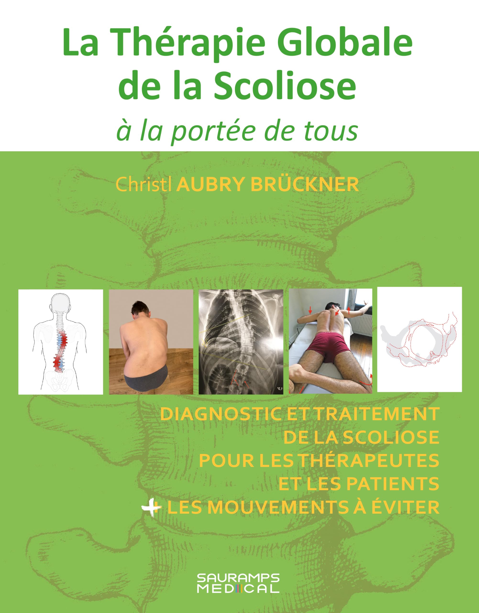 La Thérapie Globale de la Scoliose à la portée de tous: Diagnostic et traitement de la scoliose pour les thérapeutes et les patients + les mouvements à éviter