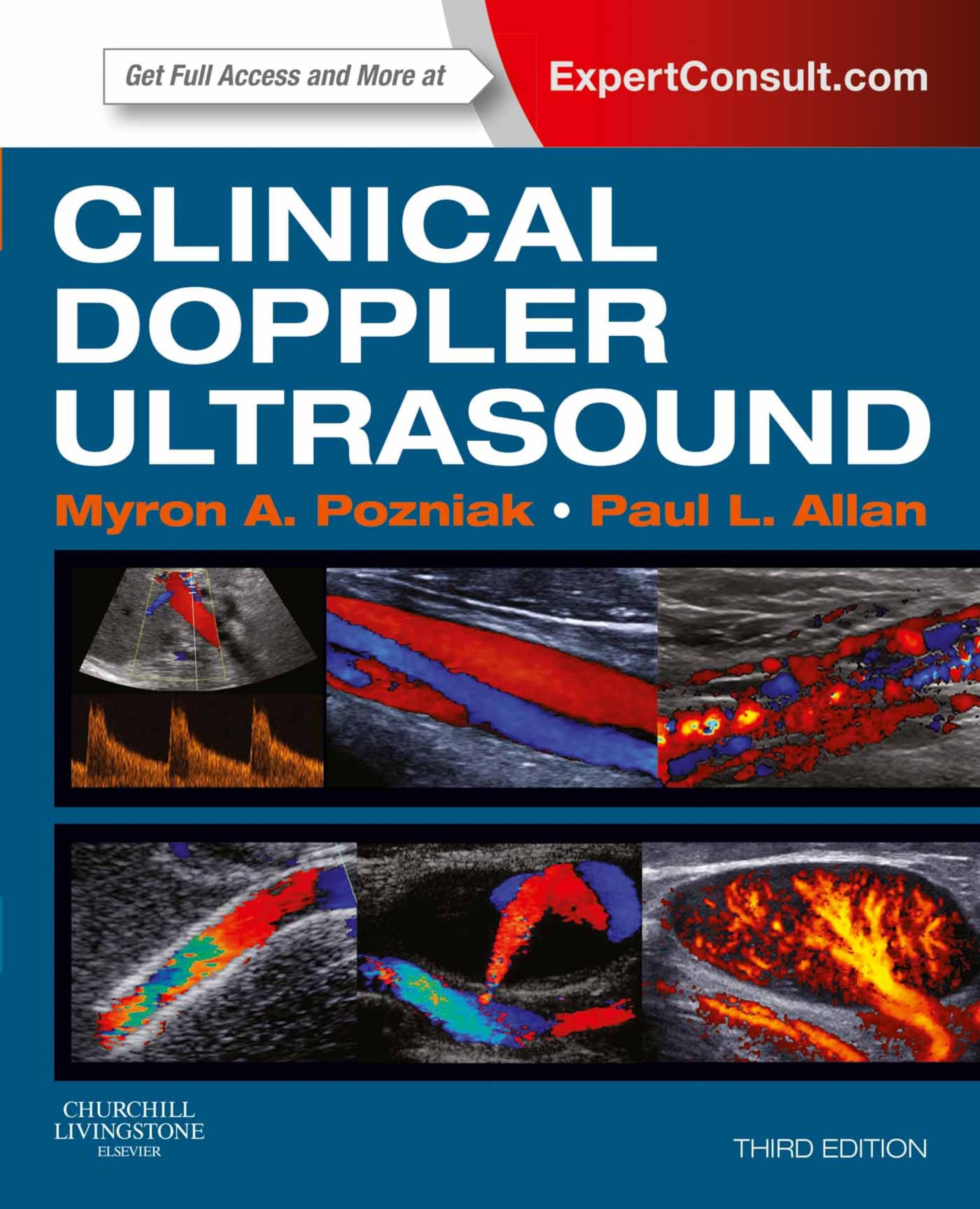 Clinical Doppler Ultrasound E-Book: Expert Consult: Online (English Edition)
