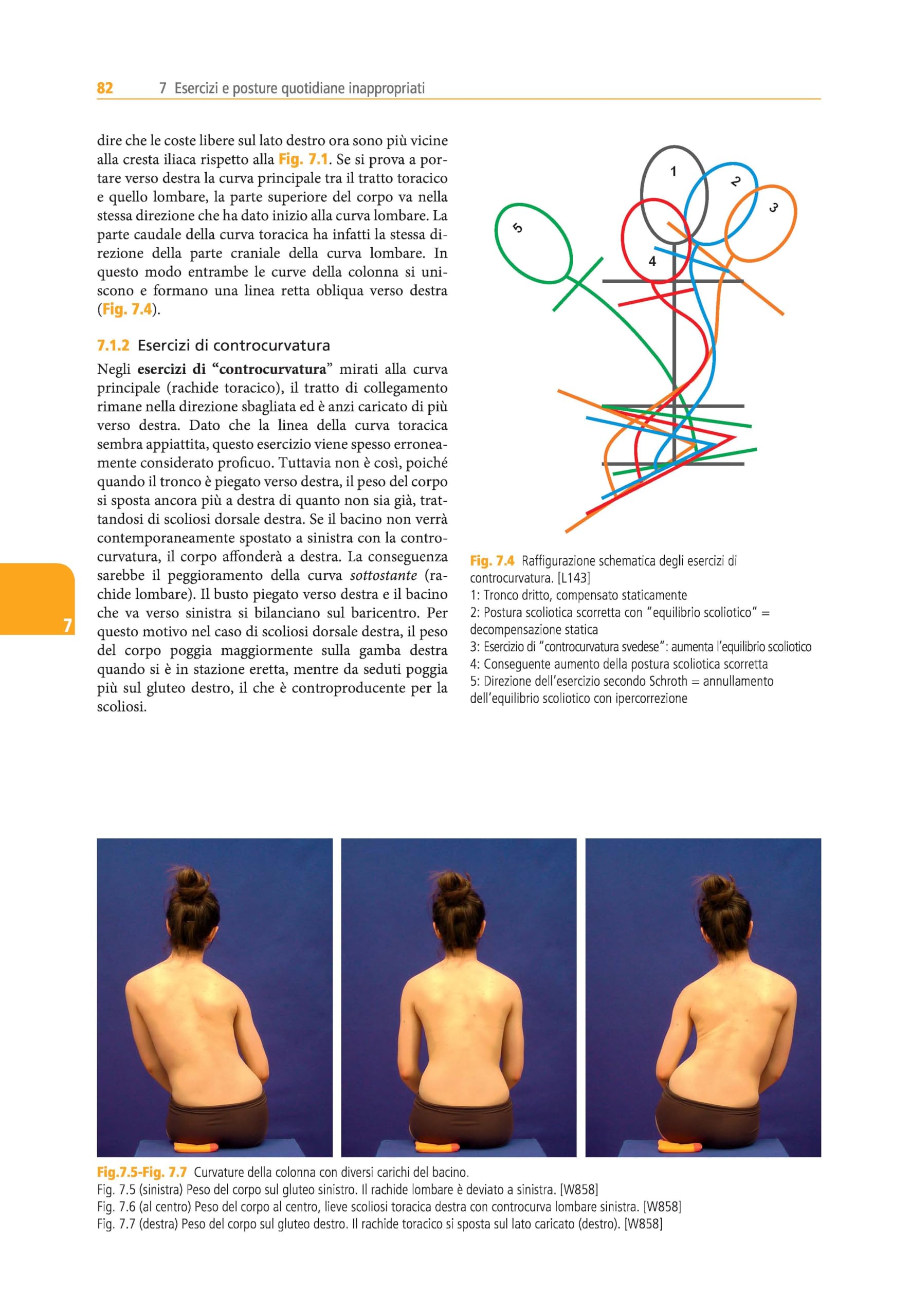 Trattamento tridimensionale della scoliosi. Ortopedia respiratoria. Metodo Schroth