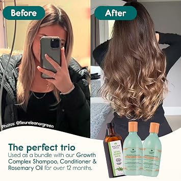 Nature Spell Hair Growth Shampoo and Conditioner Set, 10.14 Fl Oz x 2 | Improves Hair Strength, Adds Shine and Volume, Vegan, Sulfate & Paraben Free