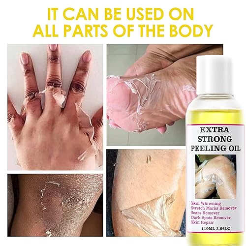 Miniatura 3 de Aceite de pelado amarillo, aceite de pelado químico para piel oscura, solución exfoliante para todo tipo de piel, aceite de pelado fuerte extra