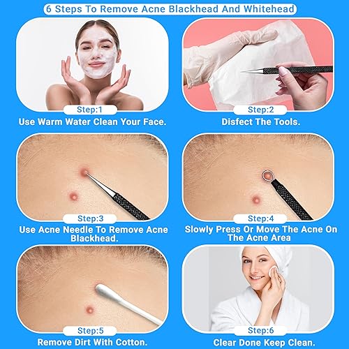 Miniatura 5 de EFAH Care - Extractor de espinillas de acero inoxidable, herramienta de tratamiento de acné, removedor quirúrgico de puntos negros, perfecto para