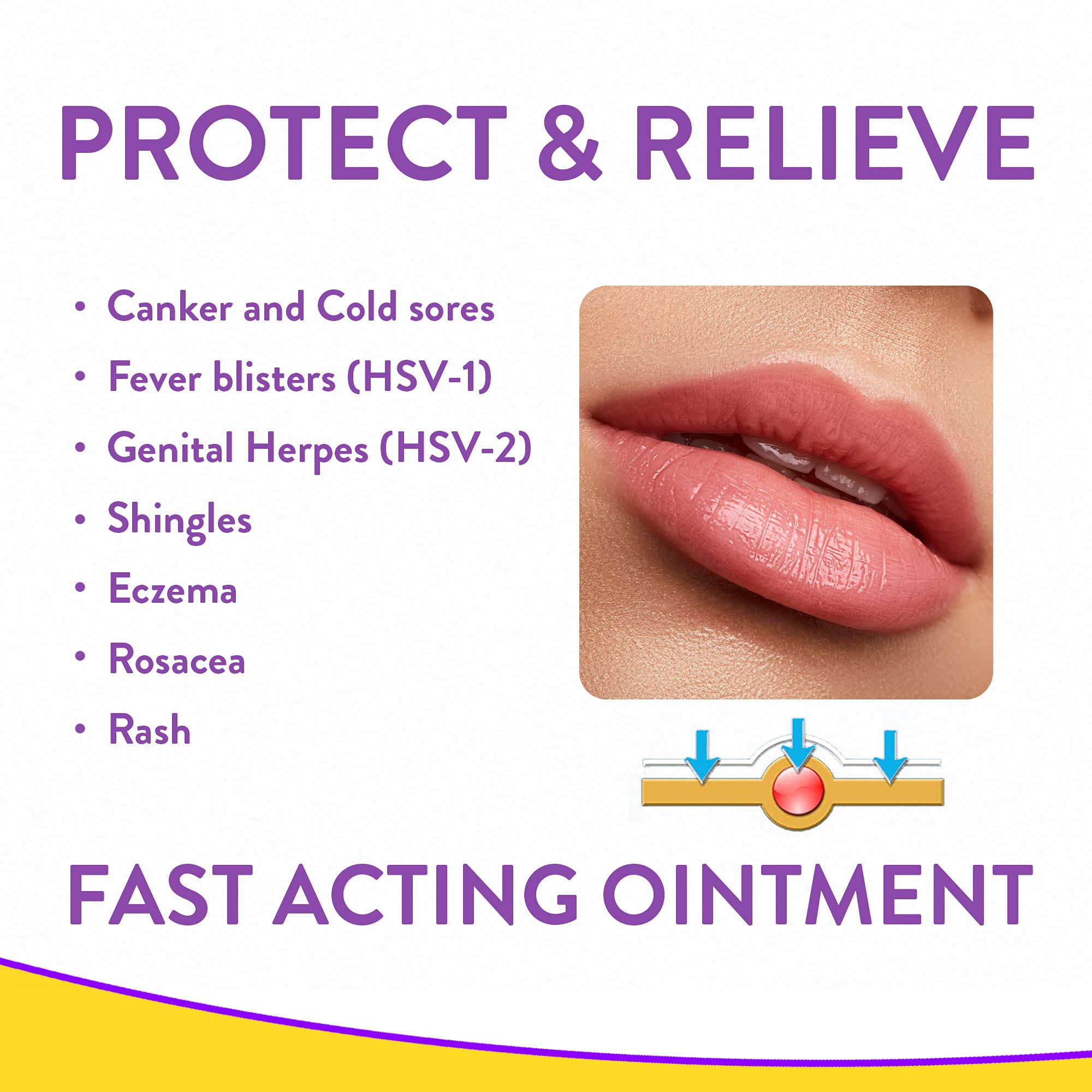 Norasil Medicated Ointment for Rash, Eczema, Cold Sores, Shingles