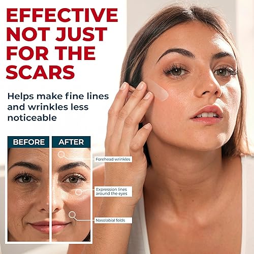 Miniatura 9 de Cinta de silicona para cicatrices de grado médico - Transparente (1.6"x60") - Diferencia visible en cicatrices quirúrgicas y queloides - Láminas