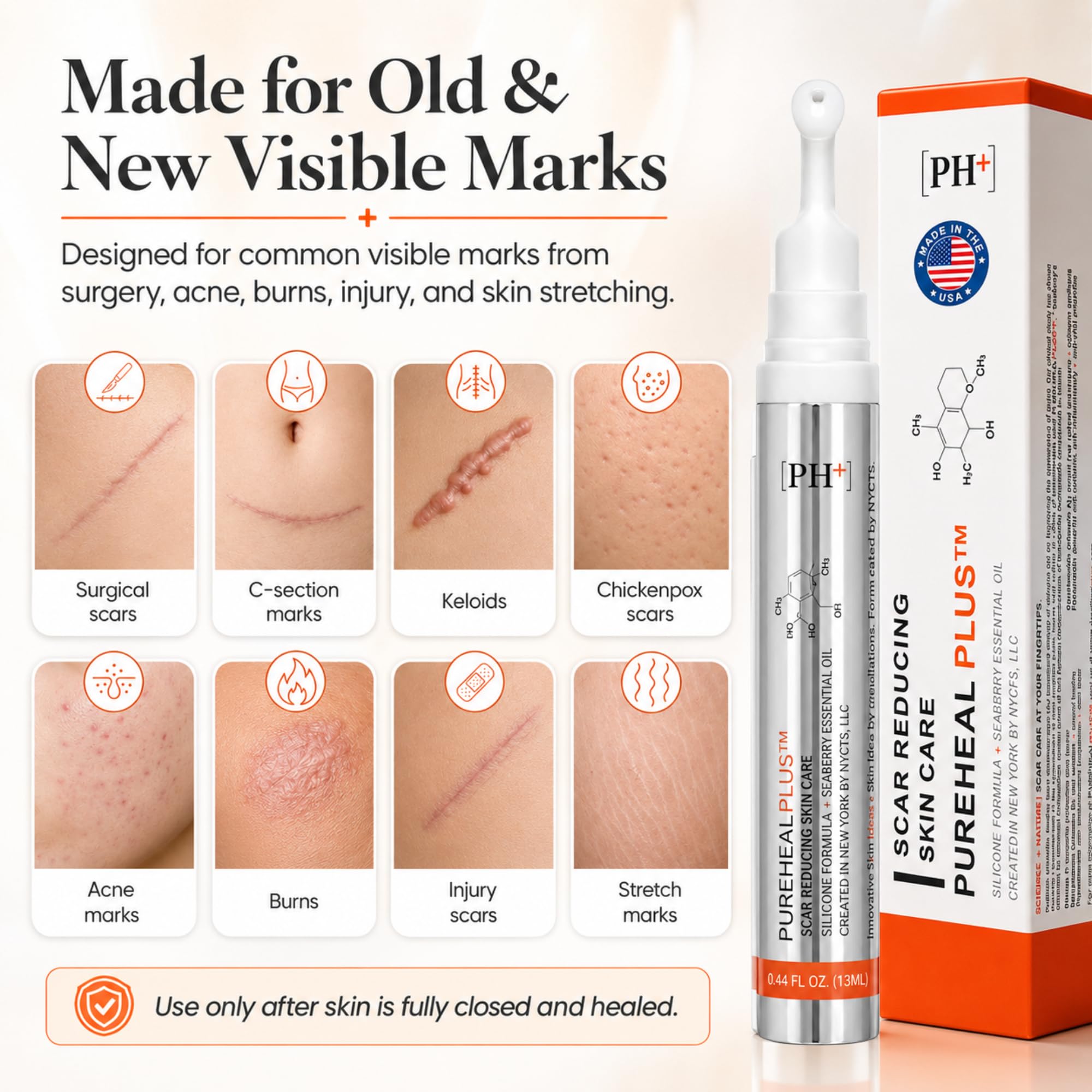Patented Silicone Gel for Scars, Surgery, Burns & Acne 13g - Surgeon-Developed Scar Removal Cream for Surgical Scars, Old & New Scars, C-Section, Keloids, Stretch Marks, Made in USA — Amazon image 6