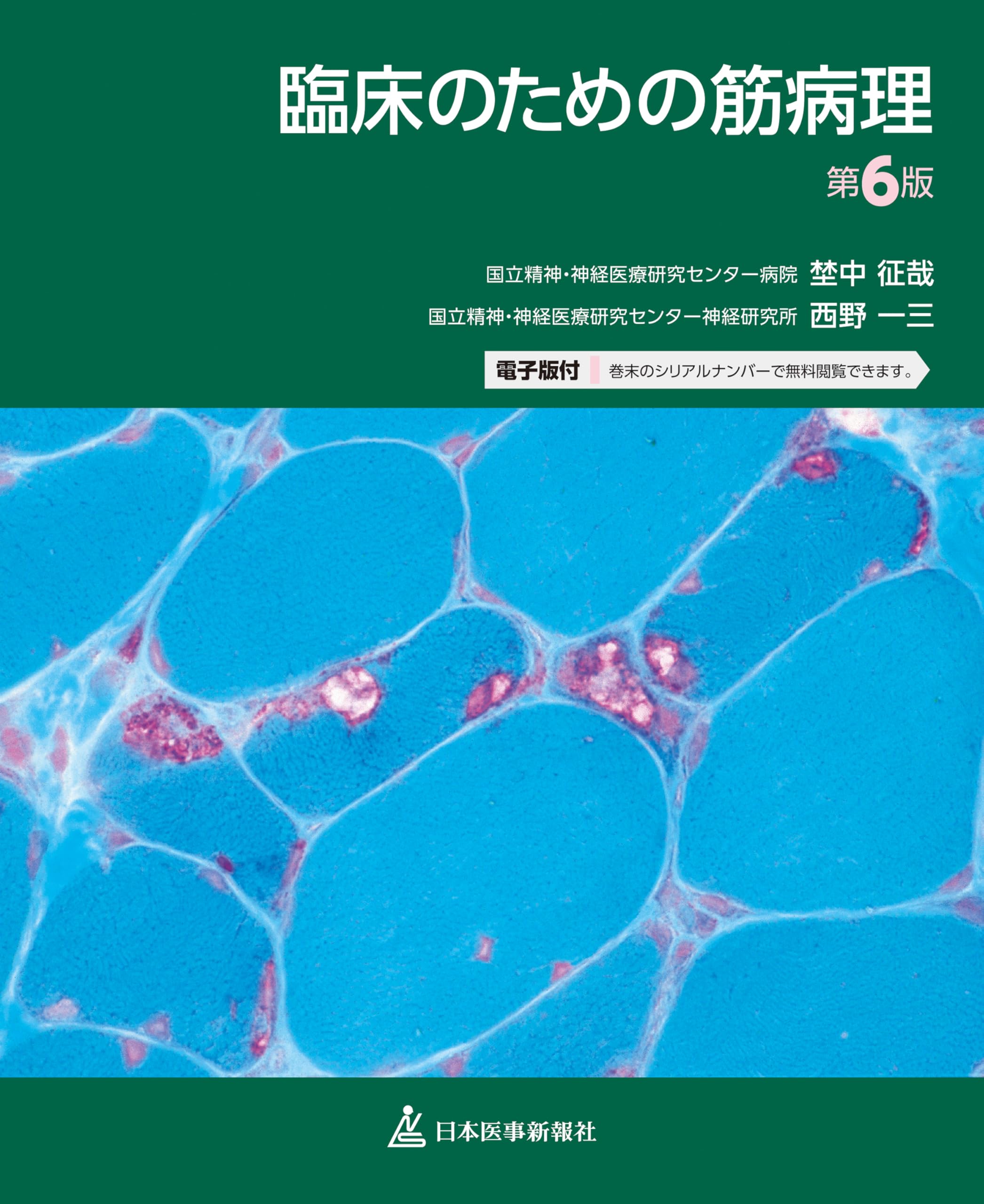 臨床のための筋病理 臨床のための筋病理 第6版 | 埜中征哉, 西野一三 |本 | 通販 | Amazon