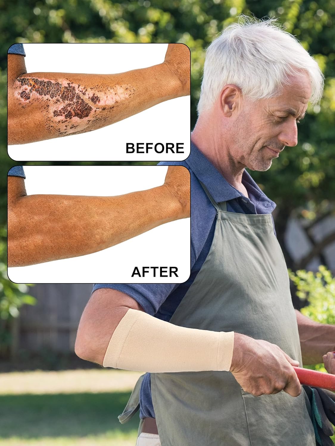 Janmercy 9 Pairs Arm Protectors for Thin Skin and Bruising Arm Guards Elderly Protective Sleeves for Gardener Working - Image 2