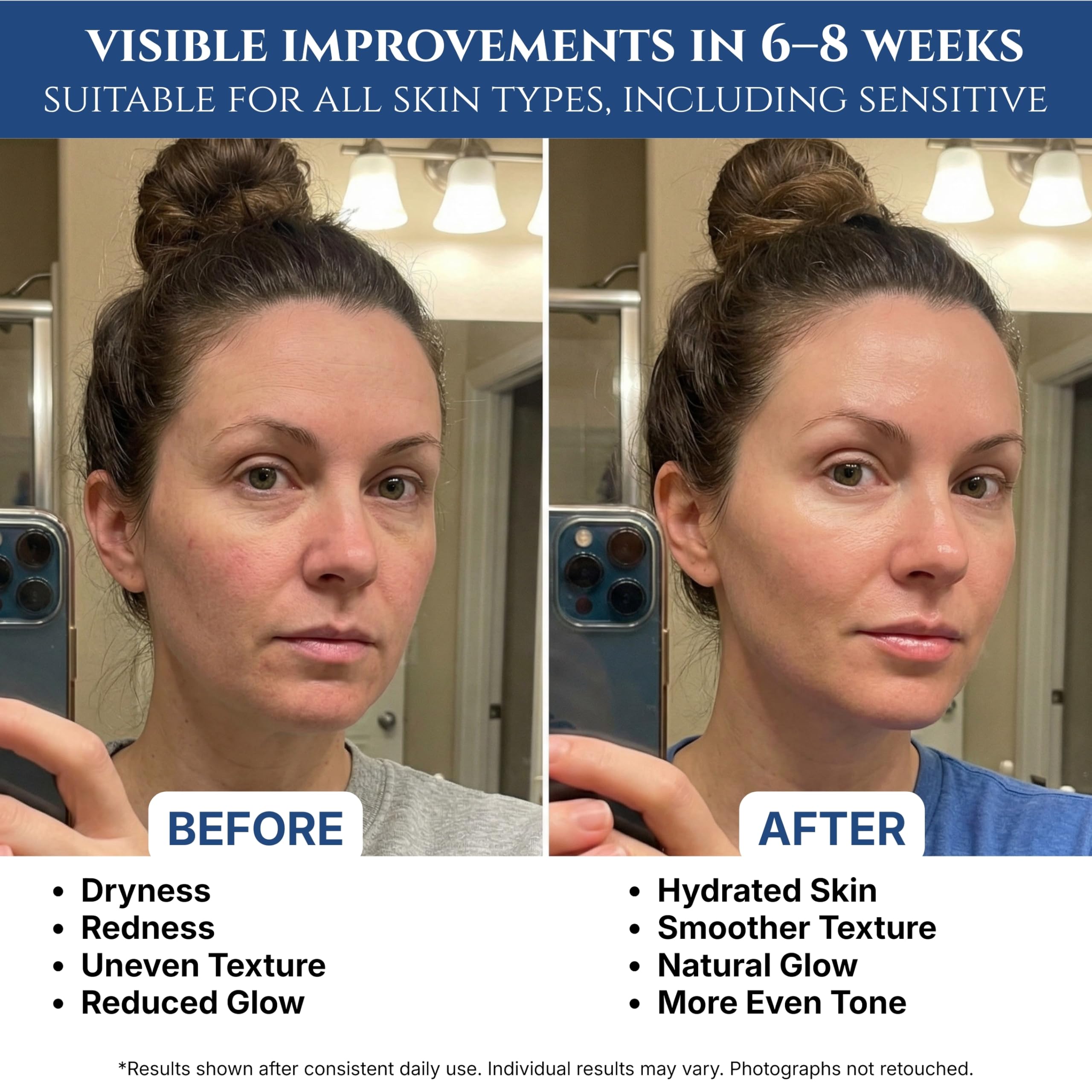 ghk-cu peptide how long to see results Buy Topical Cream for Skin Starting Week 4 Of My