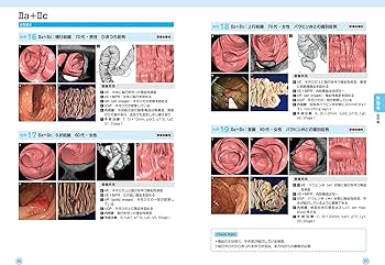 大腸CT検査~実務・症例・基礎知識~: イチから学ぶ! 大腸CT検査~実務・症例・基礎知識~: イチから学ぶ! | 東海