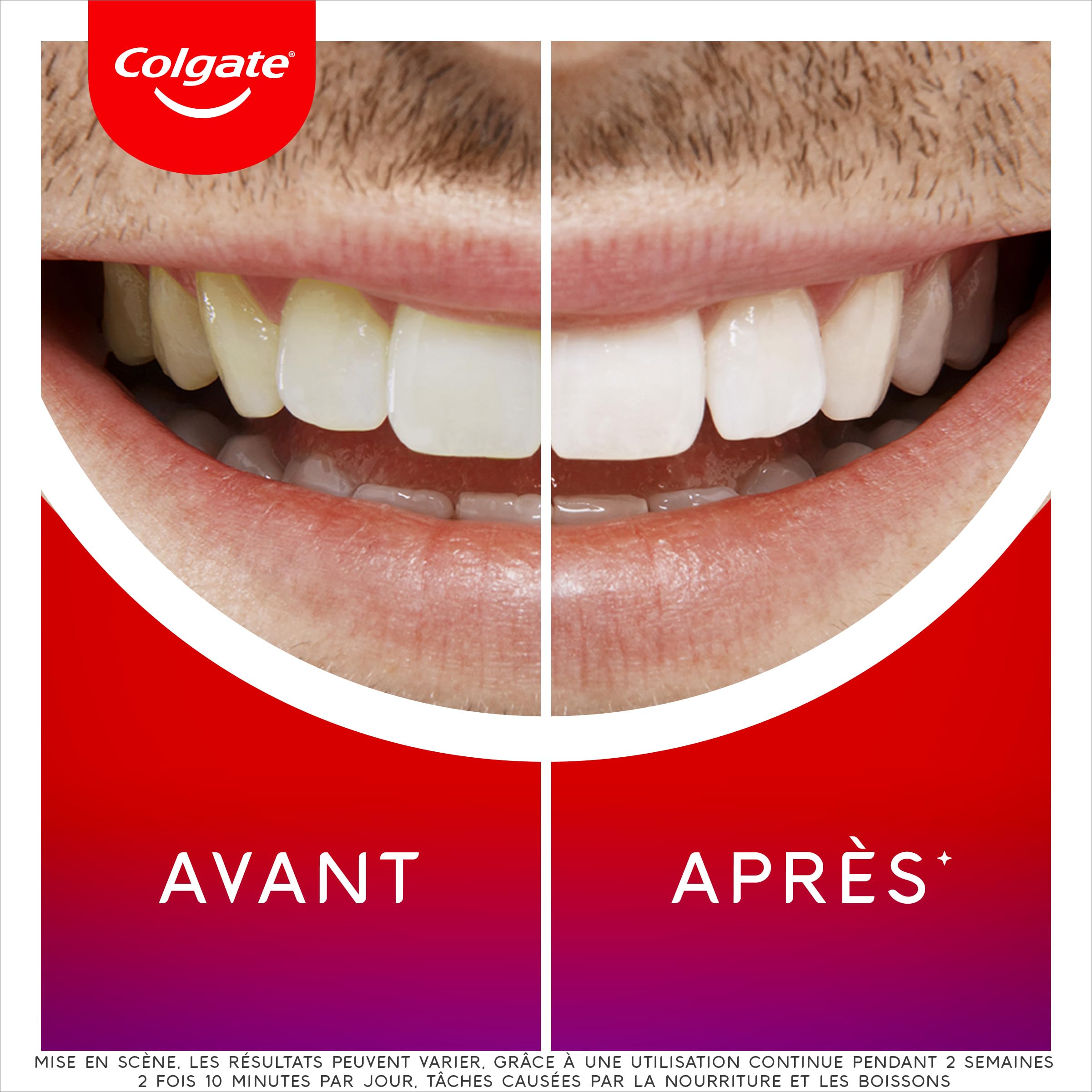 Colgate - Kit blanchiment dentaire - Sérum et dentifrice Max White Ultra - Dents plus blanches en 3 jours - 2,5ml + 75ml - Lot de 2