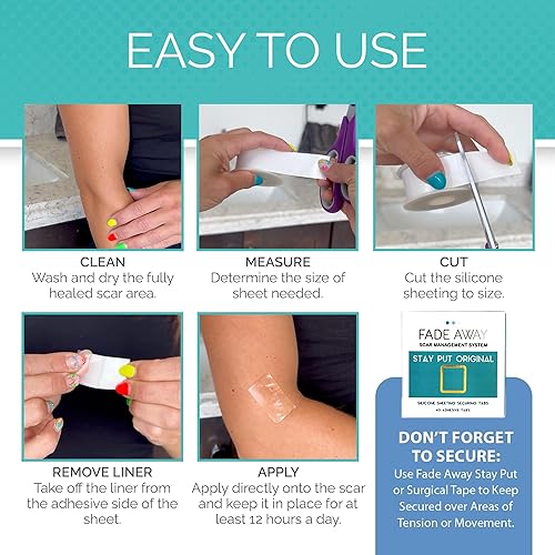 Miniatura 4 de Láminas de silicona clínicamente probadas, cinta de grado médico para cirugía, cesárea, queloides y cicatrices de abdominoplastia
