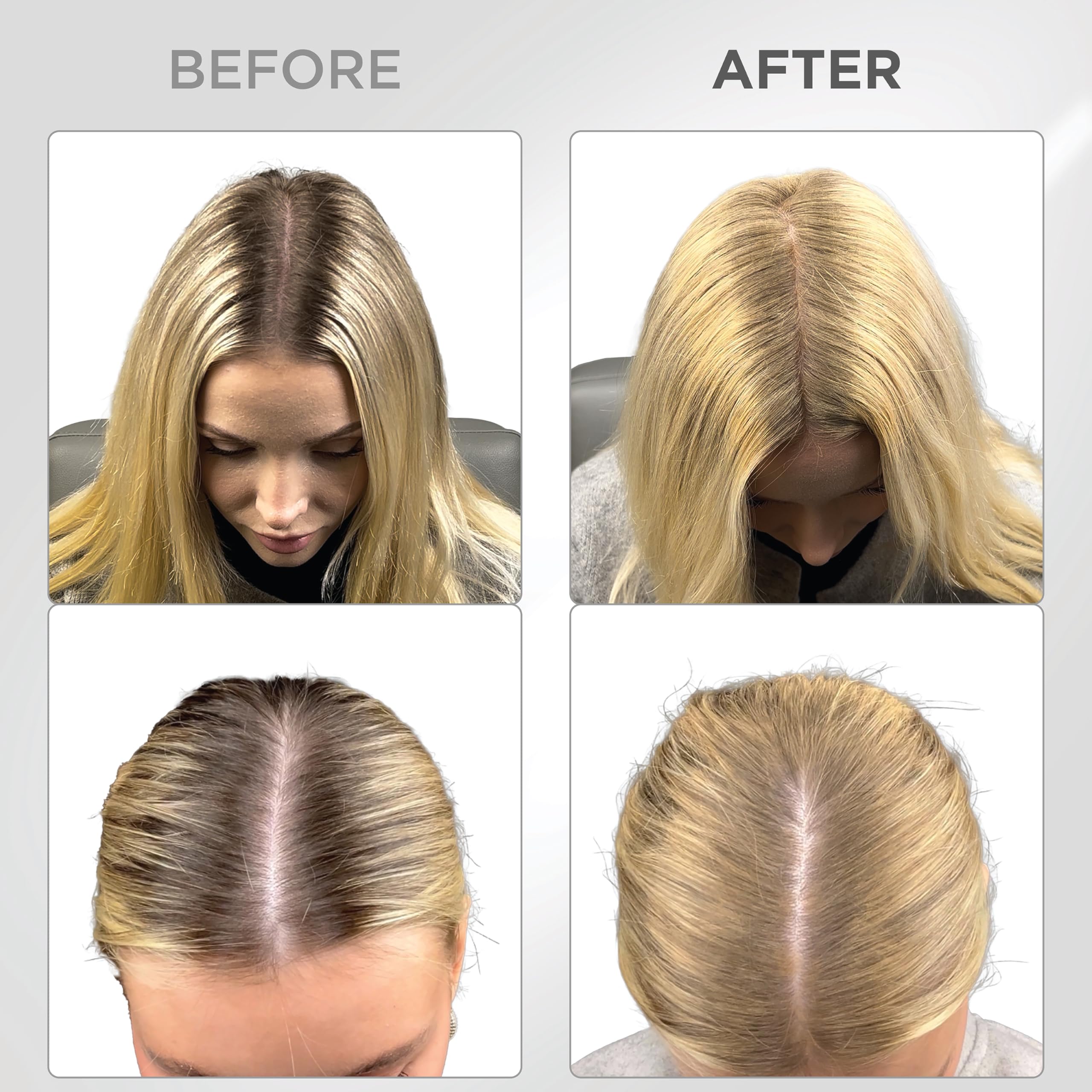 THICK FIBER Root Touch Up & Hairline Powder with Brush (LARGE 10g), Covers Grey Roots, Thinning Hair & Bald Spots - Image 3
