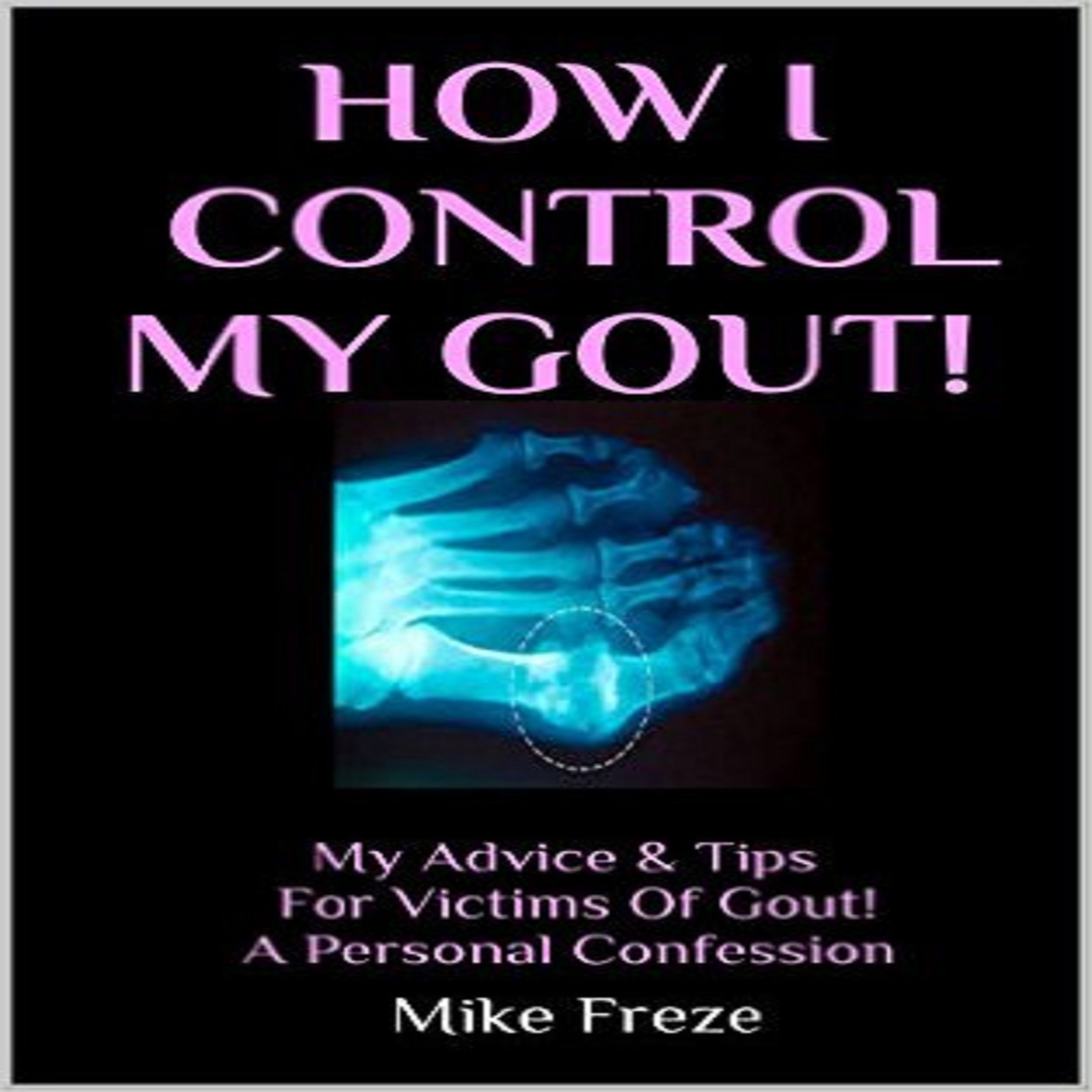 How I Control My Gout!