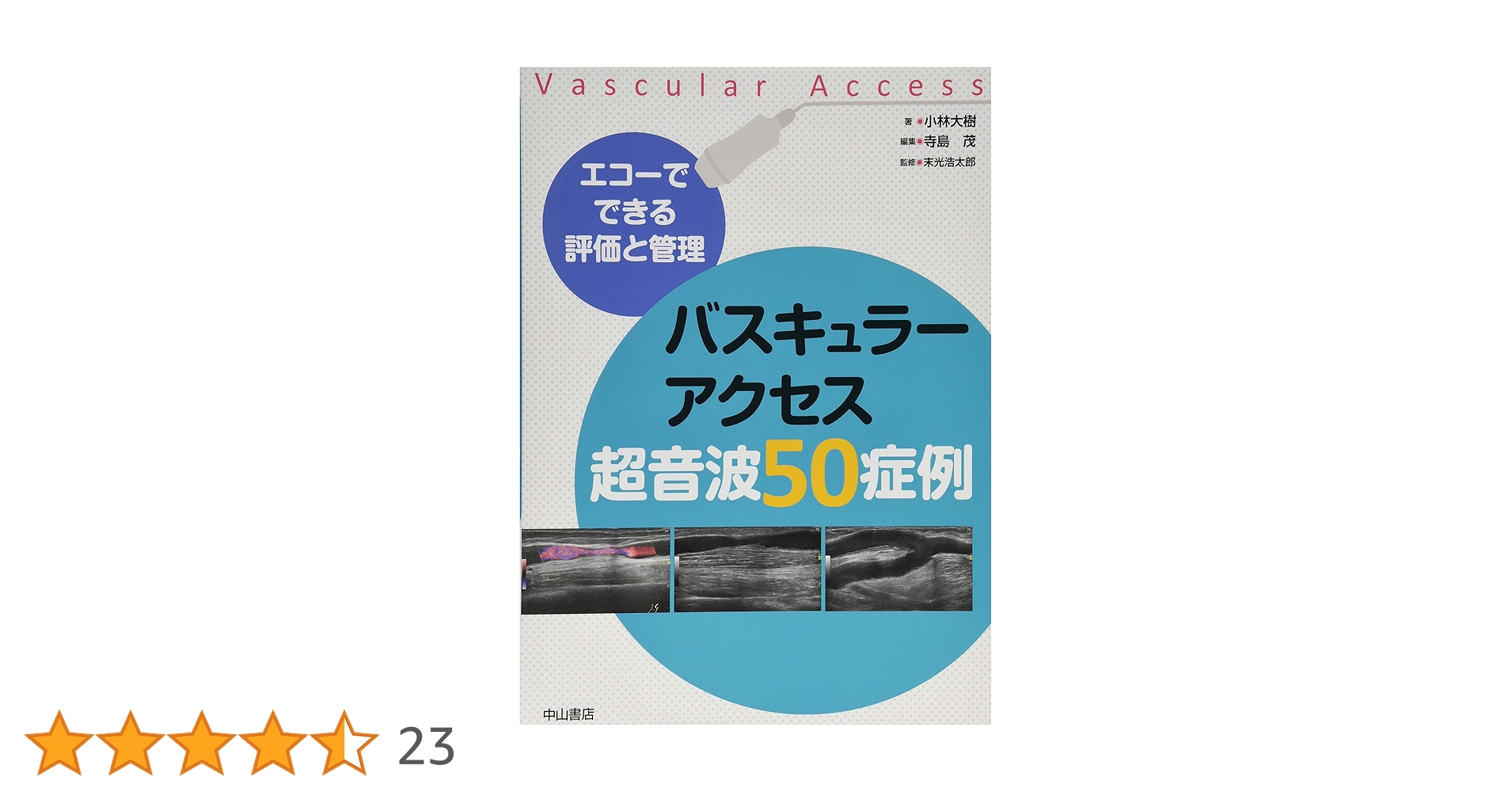 エコーでできる評価と管理 バスキュラーアクセス超音波50症例