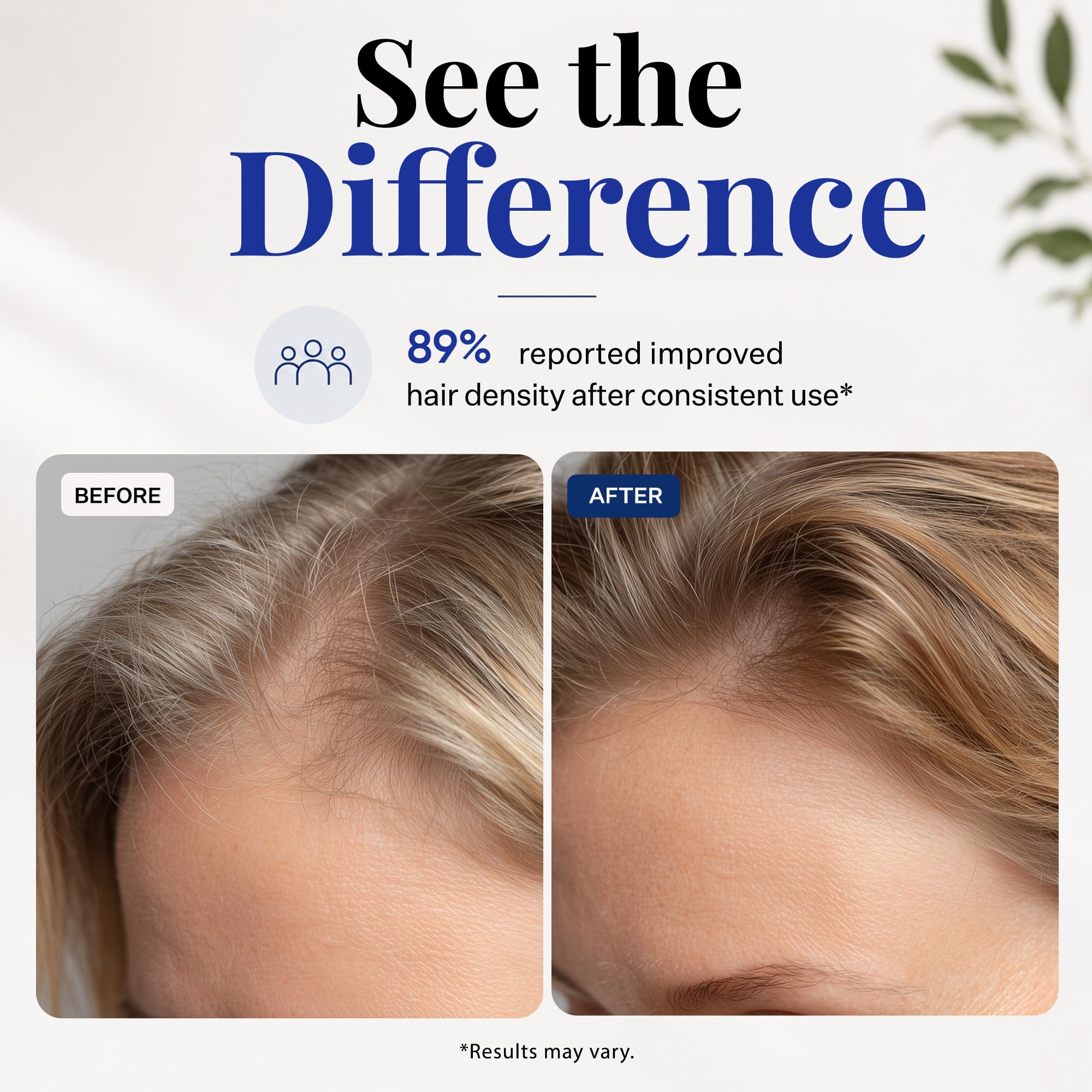 ghk cu hair growth results timeline Scalp Delivery AM/PM GHK-Cu Peptide Scalp Serum | Stem Cell Serum with Redensyl + Capixyl + AnaGain + Procapil | Multi-Peptide for Hair Density What Peptides Are Legal